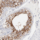 Immunohistochemical staining of human testis shows strong membranous positivity in cells in seminiferous ducts.