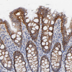 Anti-SLC16A1 Antibody