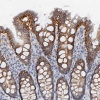Immunohistochemical staining of human colon shows strong membranous positivity in glandular cells.