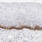 Immunohistochemical staining of human skin shows strong membranous positivity in squamous epithelial cells.