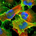 Immunofluorescent staining of human cell line U-251 MG shows localization to plasma membrane.