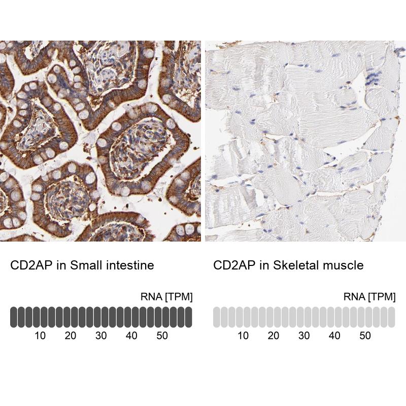 Anti-CD2AP Antibody