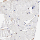 Immunohistochemical staining of human skeletal muscle shows no positivity in myocytes.