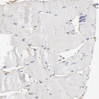 Anti-CD2AP Antibody