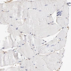 Immunohistochemical staining of human skeletal muscle shows no positivity in myocytes.