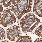 Immunohistochemical staining of human small intestine shows strong granular positivity in cytoplasm in glandular cells.
