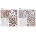 Immunohistochemical staining of human kidney, placenta, skeletal muscle and small intestine using Anti-CD2AP antibody HPA003326 (A) shows similar protein distribution across tissues to independent antibody HPA003267 (B).