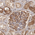 Immunohistochemical staining of human kidney shows strong membranous positivity in cells in glomeruli.