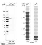 Western blot analysis in human cell lines A-431 and PC-3 using Anti-CD2AP antibody. Corresponding CD2AP RNA-seq data are presented for the same cell lines. Loading control: Anti-PFN1.