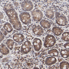 Anti-UBE2L6 Antibody