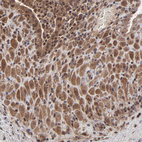 Anti-UBE2L6 Antibody