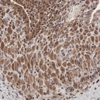 Immunohistochemical staining of human placenta shows moderate cytoplasmic positivity in decidual cells.