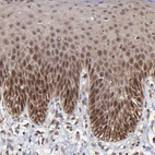 Immunohistochemical staining of human skin shows weak nuclear and cytoplasmic positivity in squamous epithelial cells.