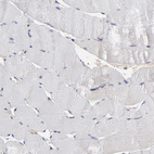 Immunohistochemical staining of human skeletal muscle shows no positivity in myocytes as expected.