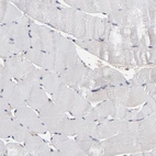 Immunohistochemical staining of human skeletal muscle shows no positivity in myocytes as expected.