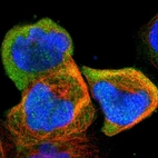 Immunofluorescent staining of human cell line A-431 shows localization to cytosol.