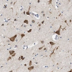 Anti-UBE2G2 Antibody