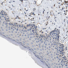 Immunohistochemical staining of human skin shows no positivity in squamous epithelial cells as expected.