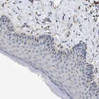 Immunohistochemical staining of human skin shows no positivity in squamous epithelial cells as expected.