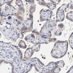 Anti-MOSPD2 Antibody
