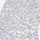 Anti-MOSPD2 Antibody