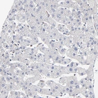 Immunohistochemical staining of human liver shows weak cytoplasmic positivity in Kupffer cells.