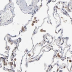 Immunohistochemical staining of human lung shows moderate cytoplasmic positivity in macrophages.
