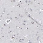Immunohistochemical staining of human cerebral cortex shows strong cytoplasmic positivity in a subset of glial cells.