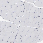 Immunohistochemical staining of human skeletal muscle shows no positivity in myocytes as expected.