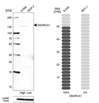 Western blot analysis in human cell lines A-549 and MCF-7 using Anti-SMARCA1 antibody. Corresponding SMARCA1 RNA-seq data are presented for the same cell lines. Loading control: Anti-PPIB.