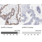 Anti-DUSP9 Antibody