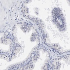 Immunohistochemical staining of human prostate shows low expression as expected.