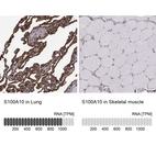 Anti-S100A10 Antibody
