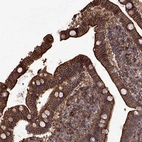 Immunohistochemical staining of human small intestine shows strong membranous positivity in glandular cells.