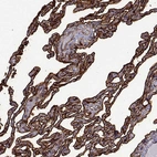 Immunohistochemical staining of human lung shows strong membranous positivity in macrophages.