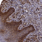 Immunohistochemical staining of human skin shows strong membranous positivity in squamous epithelial cells.