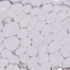 Immunohistochemical staining of human skeletal muscle shows no membranous positivity in myocytes as expected.