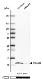 Western blot analysis in Caco-2 cells transfected with control siRNA, target specific siRNA probe #1, using Anti-S100A10 antibody. Remaining relative intensity is presented. Loading control: Anti-GAPDH.