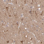 Anti-CNTN3 Antibody