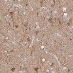Anti-CNTN3 Antibody