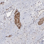 Anti-CHL1 Antibody