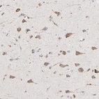 Anti-RNF213 Antibody