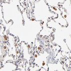 Anti-RNF213 Antibody