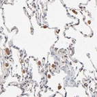Immunohistochemical staining of human lung shows moderate cytoplasmic positivity in macrophages.