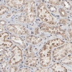Immunohistochemical staining of human kidney shows moderate cytoplasmic positivity in cells in tubules.