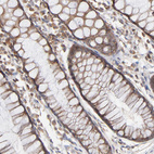 Immunohistochemical staining of human rectum shows moderate cytoplasmic positivity in glandular cells.