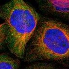 Immunofluorescent staining of human cell line A-431 shows localization to cytosol.