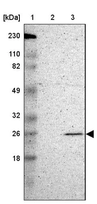 Lane 1: Marker [kDa] 230, 110, 82, 49, 32, 26, 18_br/_Lane 2: Human cell line RT-4_br/_Lane 3: Human cell line U-251MG sp