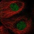 Immunofluorescent staining of human cell line A-431 shows localization to nucleoplasm.