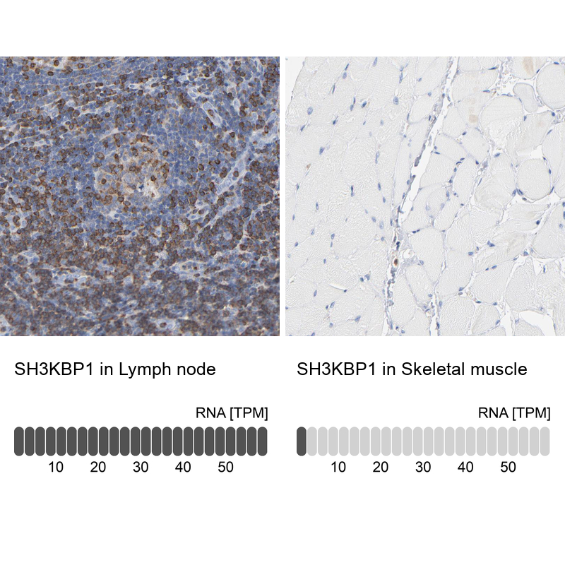Anti-SH3KBP1 Antibody